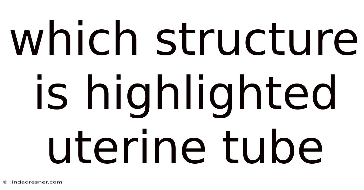 Which Structure Is Highlighted Uterine Tube
